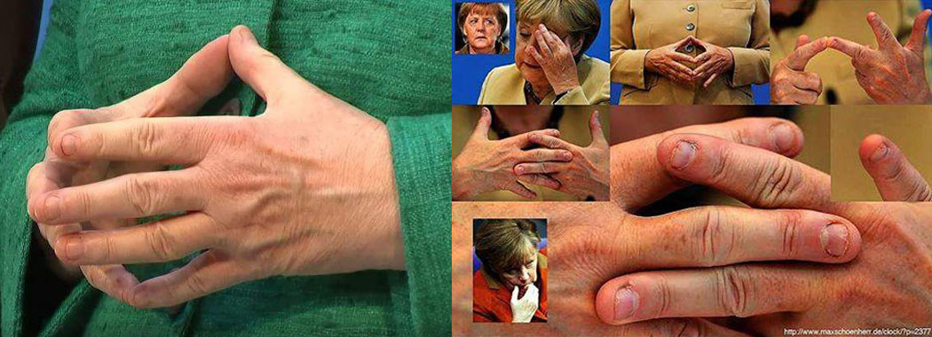 Merkel´s offensichtlich psychische Probleme